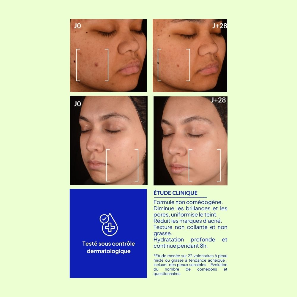 etude clinique marque blanche acne